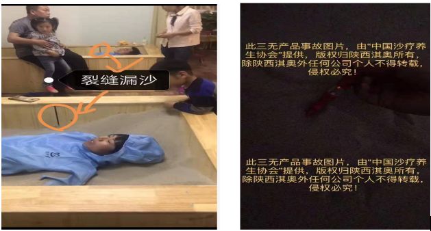 沙疗的真假分辨及价格、优劣对比(图77)