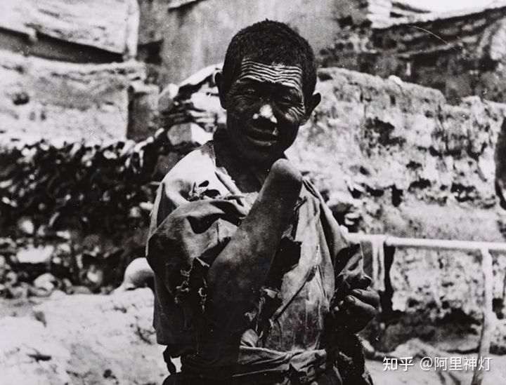 触目惊心的西藏农奴照片，悲惨生活，暗无天日！（​这组照片有点残忍，胆小者请慎入）(图8)