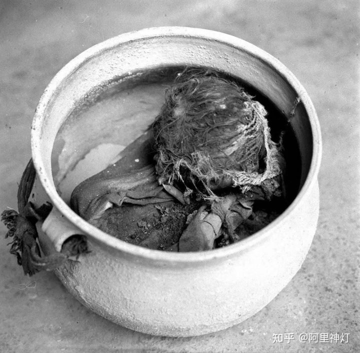 触目惊心的西藏农奴照片，悲惨生活，暗无天日！（​这组照片有点残忍，胆小者请慎入）(图9)