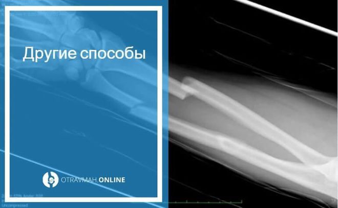 普京部分动员令下，如何弄断手臂成了俄罗斯最受欢迎的谷歌搜索词(图4)