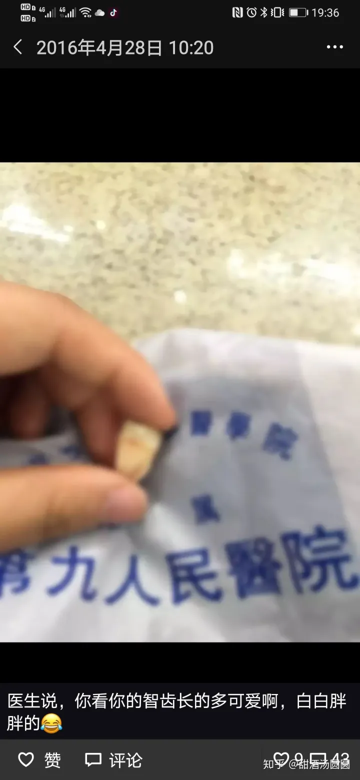 我在长沙市口腔医院补牙全过程及经验分享(图5)